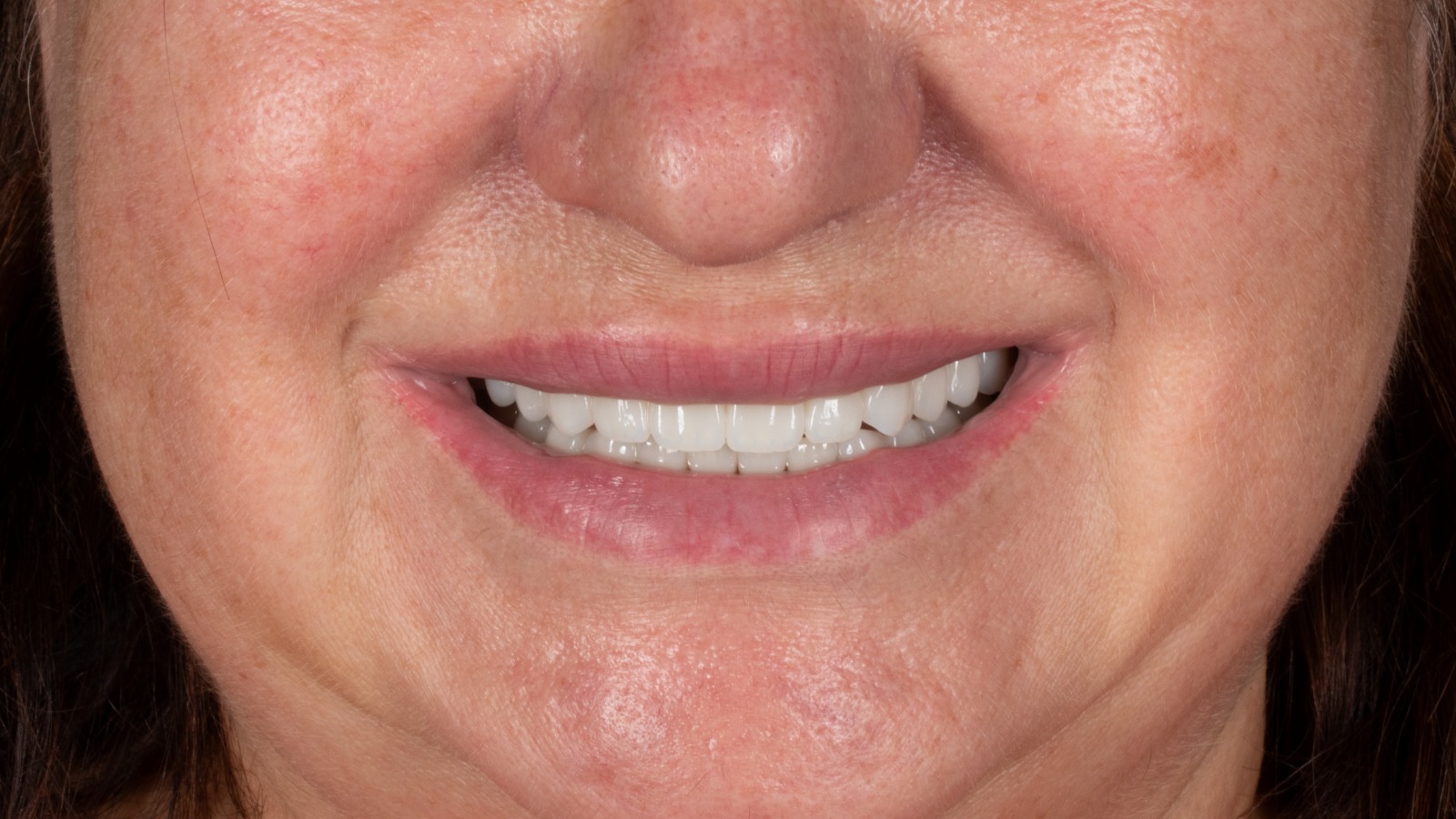 Case Study | Helen