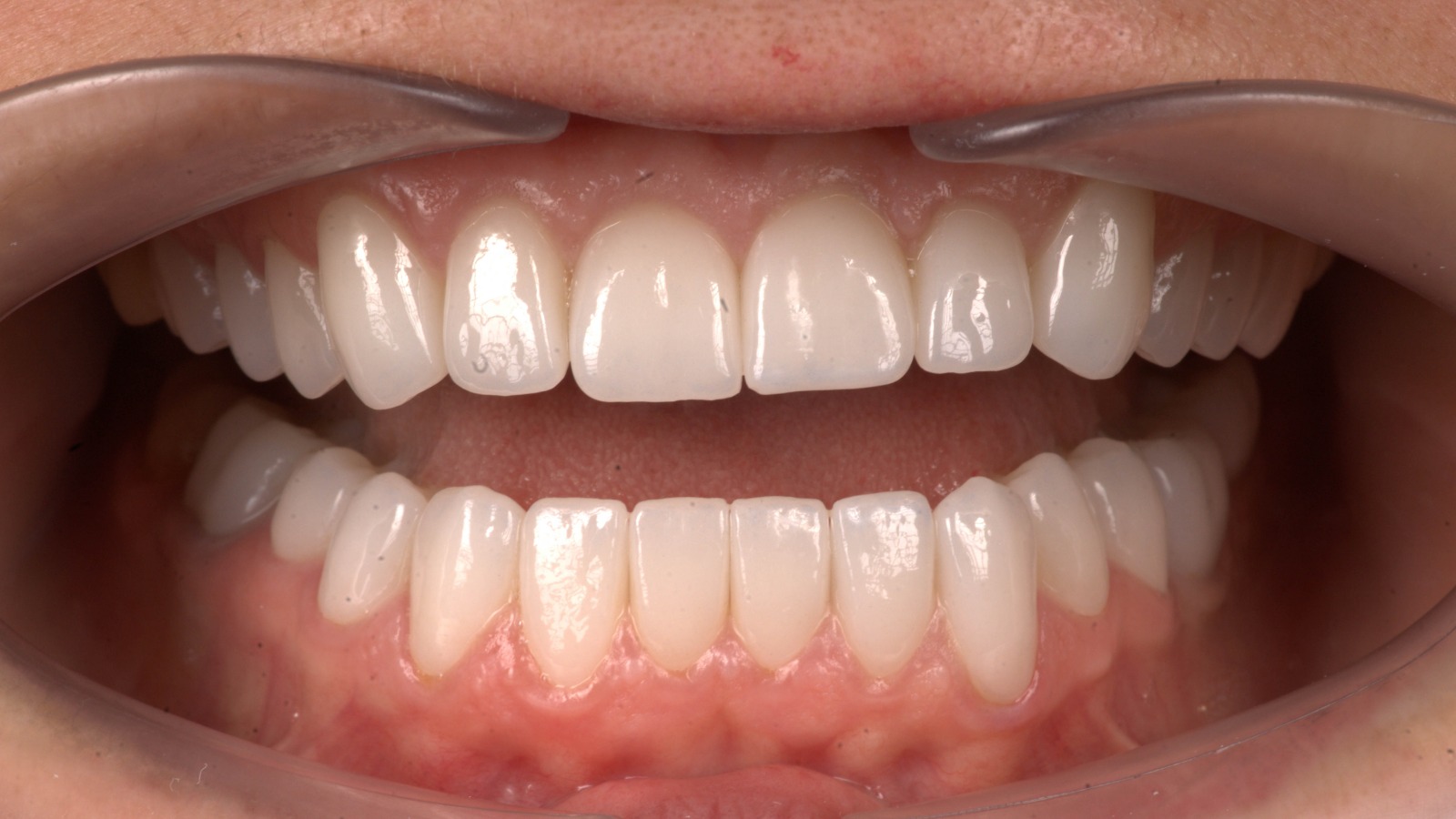 Case Study | Mariana
