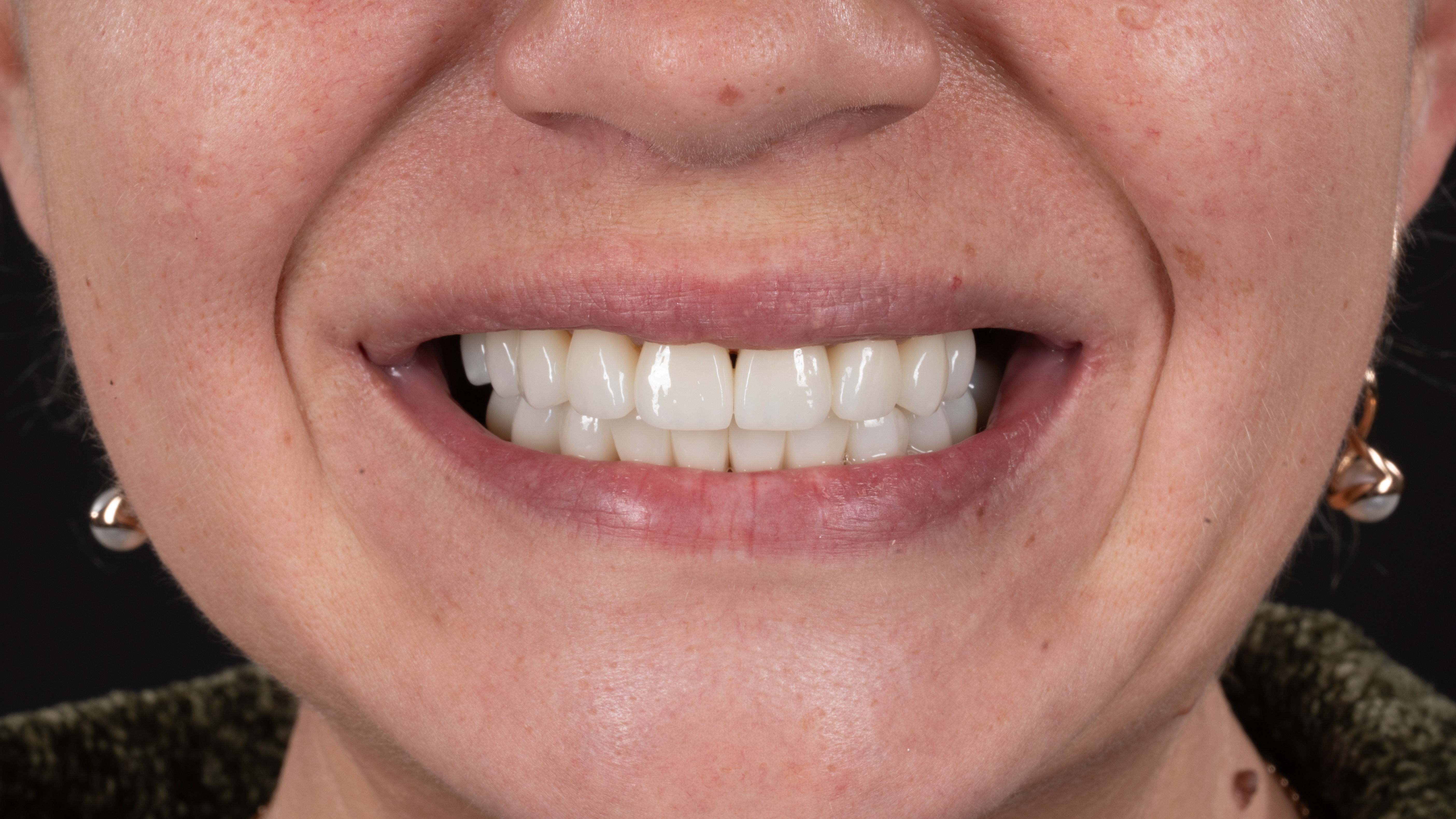 Case Study | Nadia