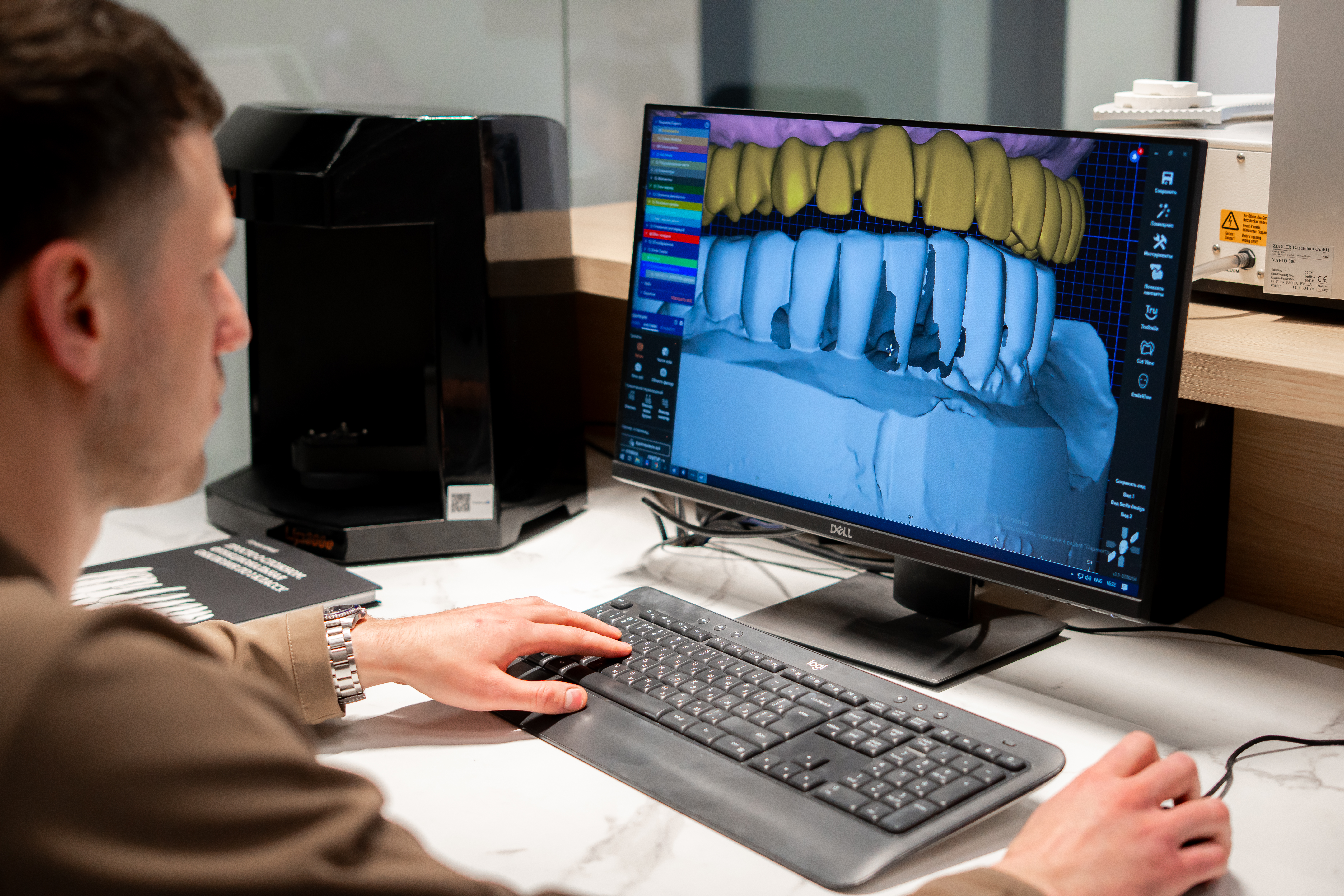 In-house dental lab